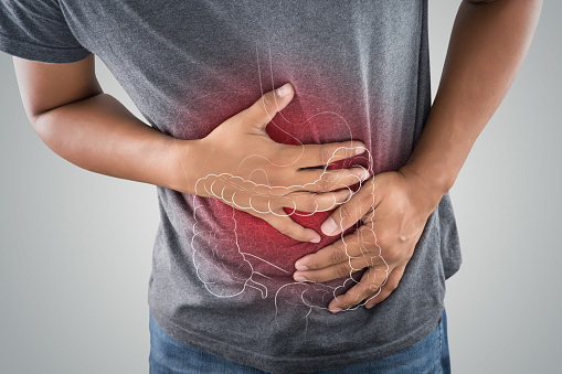 Bowel Perforation Symptoms, Causes, Treatment