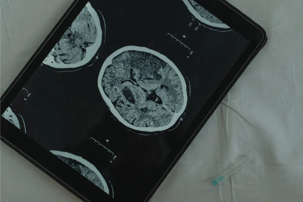 When Do You Need Medical Imaging