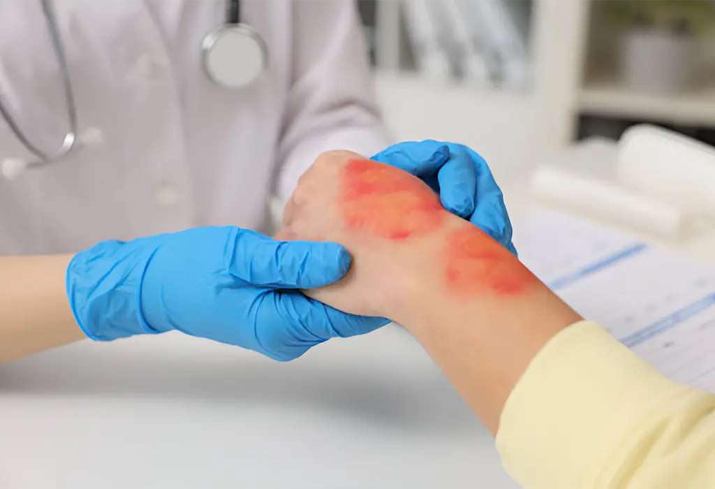 Emergency Room for Burn Treatment in Jersey Village TX