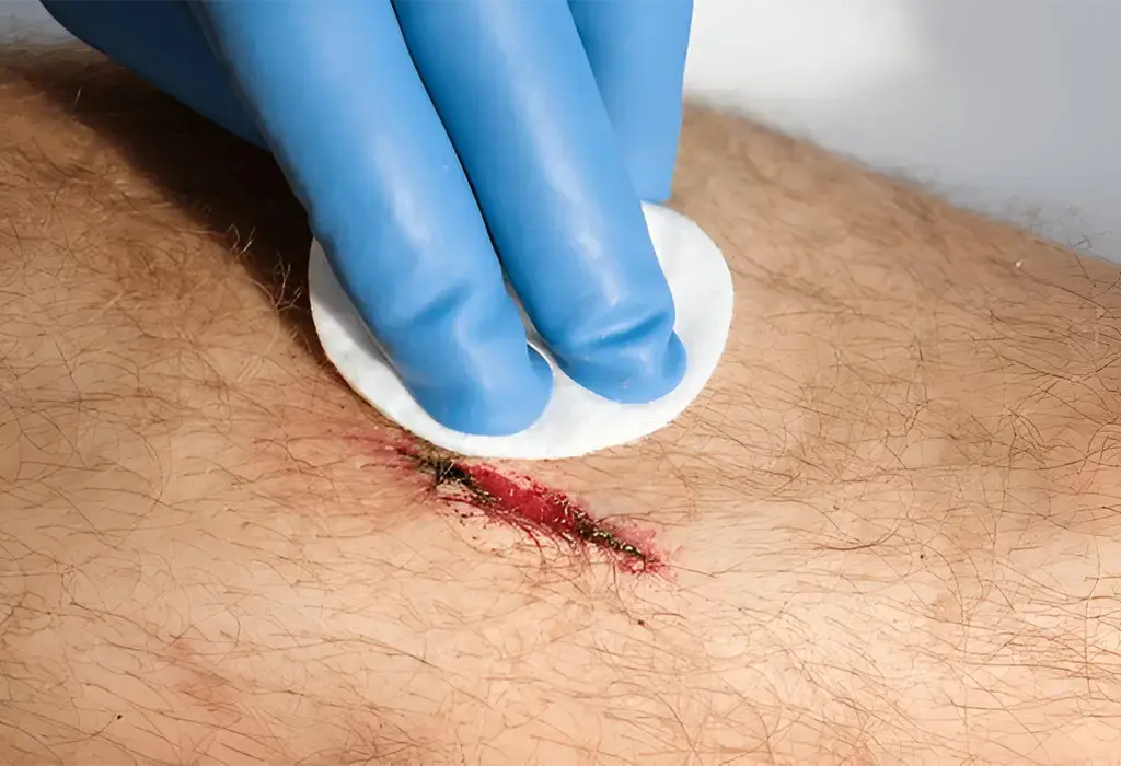 Emergency Room for Cuts, Lacerations, Scrapes & Gashes Treatment in Jersey Village TX