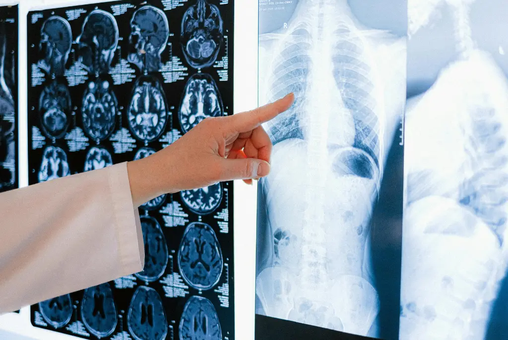 Emergency Room for X-Ray Services in Jersey Village TX