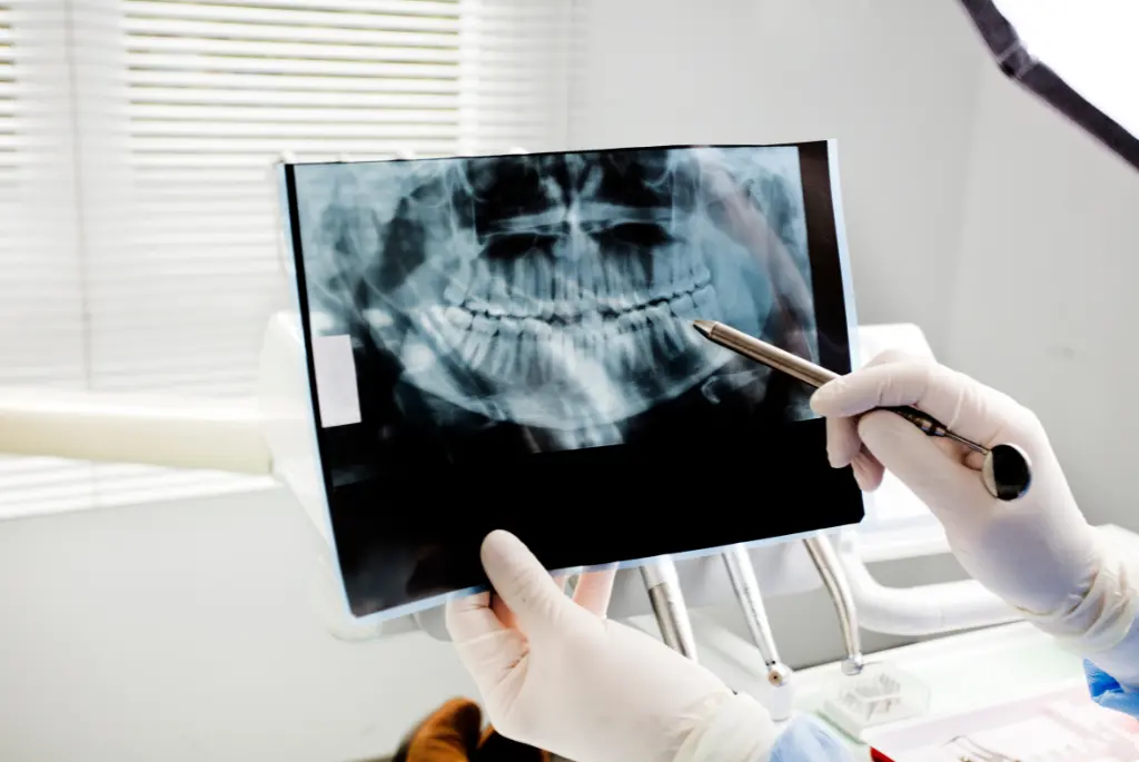 When Do You Need an X-Ray
